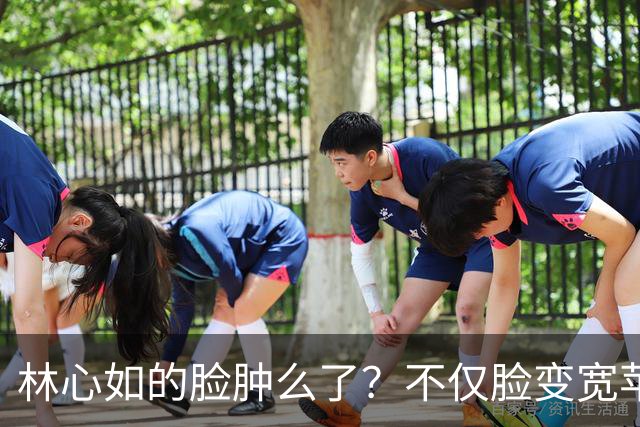 林心如的脸肿么了？不仅脸变宽苹果肌高耸连鼻子也变尖变长很奇怪